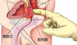 前列腺按摩视频,专业视频解析与操作指南